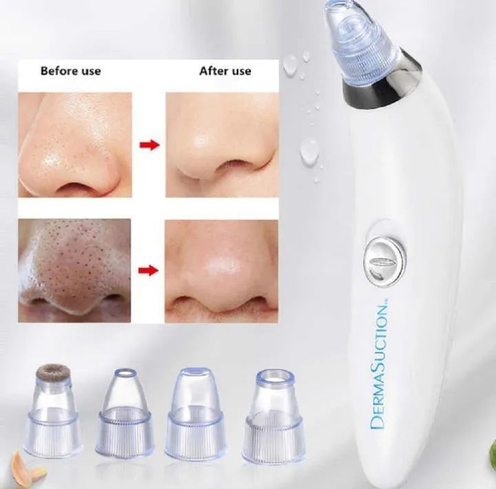 Derma Suction Facial Cleanser - Electric Pore Vacuum Blackhead Remover with 4 Suction Heads
