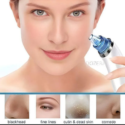 Derma Suction Facial Cleanser - Electric Pore Vacuum Blackhead Remover with 4 Suction Heads