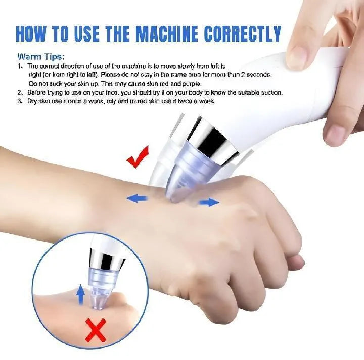 Derma Suction Facial Cleanser - Electric Pore Vacuum Blackhead Remover with 4 Suction Heads