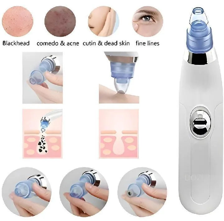 Derma Suction Facial Cleanser - Electric Pore Vacuum Blackhead Remover with 4 Suction Heads