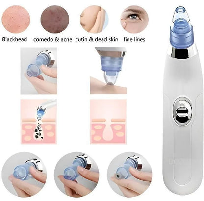 Derma Suction Facial Cleanser - Electric Pore Vacuum Blackhead Remover with 4 Suction Heads