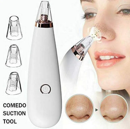 Derma Suction Facial Cleanser - Electric Pore Vacuum Blackhead Remover with 4 Suction Heads